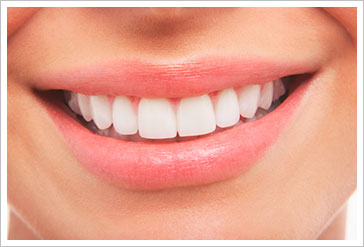 金屬牙冠  金屬瓷牙冠  全瓷冠